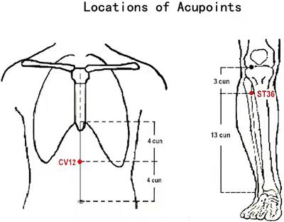 Neural Responses of Acupuncture for Treating Functional Dyspepsia: An fMRI Study